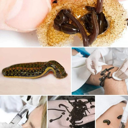 Doğal Göl Sülüğü 10 Adet Ufak Boy Yüz Için   (Kan Sülüğü)